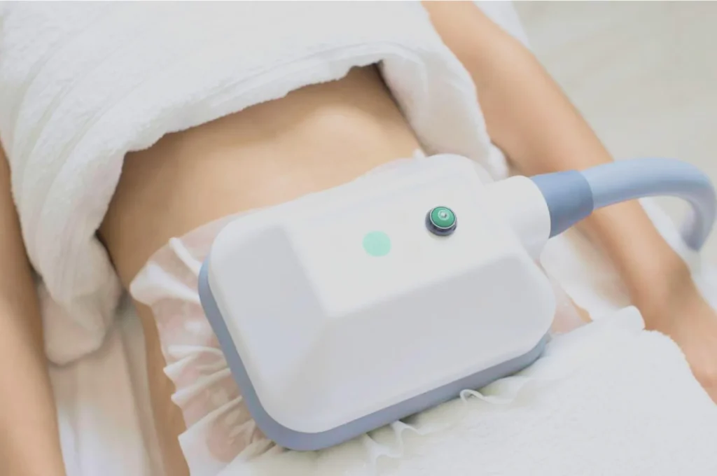 How Fat Freezing and HIFU Work Together? 3 advantages to combining Fat Freezing and HIFU Brighton