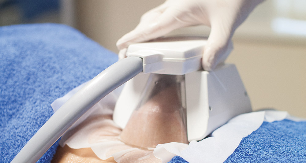 How Fat Freezing and HIFU Work Together? 2 Multiple Areas in One Session HIFU and Fat Freezing Brighton