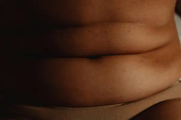 The Hidden Connection: How Stress Shapes Your Fitness and Body Composition 3 image of what stress can do on the stomach area and how Lipo 360 Brighton can help to change your body shape.